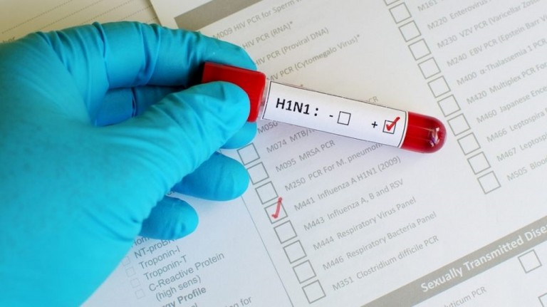  Wirus świńskiej grypy w kępińskim szpitalu