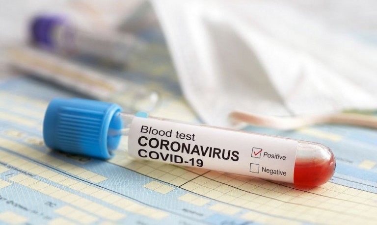  Do 174 wzrosła liczba osób zarażonych koronawirusem w powiecie kępińskim