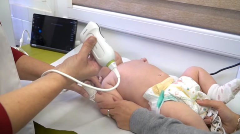  USG płuc na oddziale pediatrycznym w Wieruszowie 