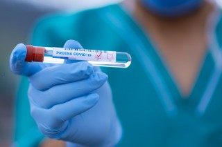  307 osób jest już zdiagnozowanych z obecnością koronawirusa w powiecie kępińskim